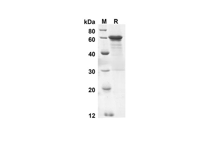 SDS-PAGE analysis of Human CANX proteins, 2 μg/lane of Recombinant Human CANX proteins was resolved with SDS-PAGE under reducing conditions, showing bands at 55.9 kDa.