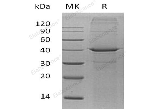 Recombinant Human Arginase-2/ARG2 Protein (His Tag) - ABMIUM