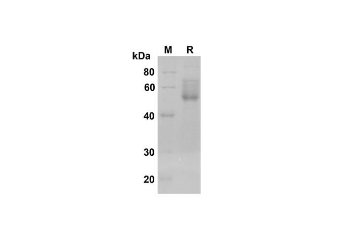 SDS-PAGE analysis of Human DKK-3 proteins , 2 μg/lane of Recombinant Human DKK-3 proteins was resolved with SDS-PAGE under reducing conditions , showing bands at 50 kDa.