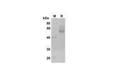 SDS-PAGE analysis of Human DKK-3 proteins , 2 μg/lane of Recombinant Human DKK-3 proteins was resolved with SDS-PAGE under reducing conditions , showing bands at 50 kDa.