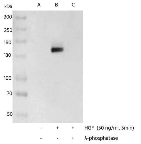Anti-Human MET Antibody [B294] - ABMIUM