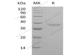 Recombinant Human CRHBP Protein (His Tag) - ABMIUM