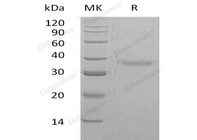 Recombinant Human CRHBP Protein (His Tag) - ABMIUM