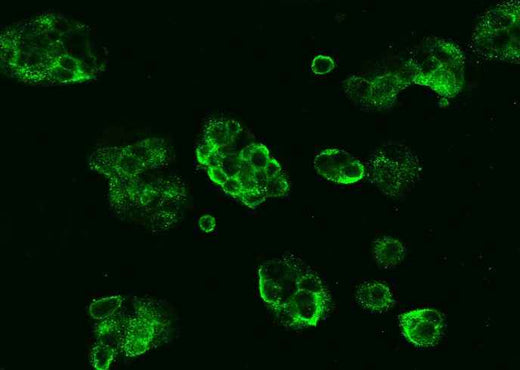 Anti-Human NT5E Antibody [B276] - ABMIUM