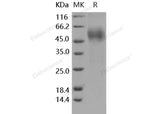 Recombinant Human OBCAM/OPCML Protein (His Tag) - ABMIUM