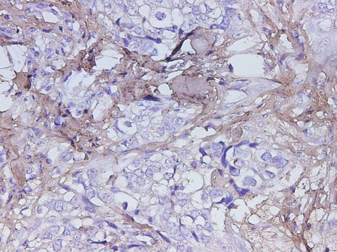 Anti-Human POSTN Antibody - ABMIUM