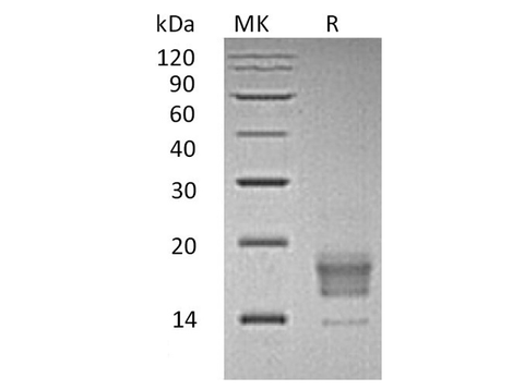 Recombinant Human TIGIT Protein (aa 22-141, His Tag) - ABMIUM
