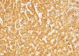 Anti-Human SerpinD1 Antibody [A1296] - ABMIUM