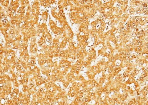 Anti-Human SerpinD1 Antibody [A1296] - ABMIUM