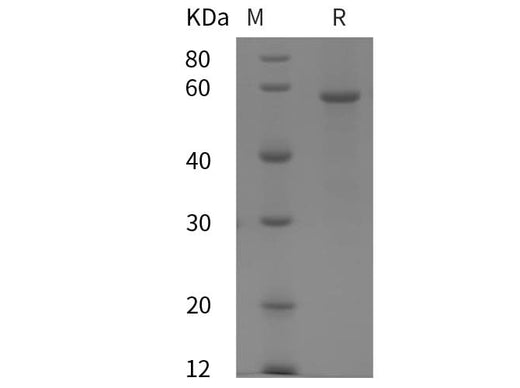 SDS-PAGE analysis of Human PIGR/SC proteins, 2 μg/lane of Recombinant Human PIGR/SC proteins was resolved with SDS-PAGE under reducing conditions, showing bands at 59 kDa.