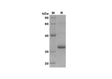SDS-PAGE analysis of Human VWF F8VWF proteins, 2 μg/lane of Recombinant Human VWF F8VWF proteins was resolved with SDS-PAGE under reducing conditions, showing bands at 32 kDa.