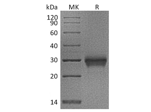 Recombinant Cynomolgus CD40/TNFRSF5/CD40L receptor Protein (His Tag) - ABMIUM