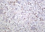 Anti-Human/Mouse PPAR-γ Antibody [B1164]