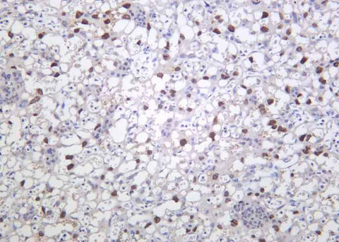Anti-Human/Mouse PPAR-γ Antibody [B1164] - ABMIUM