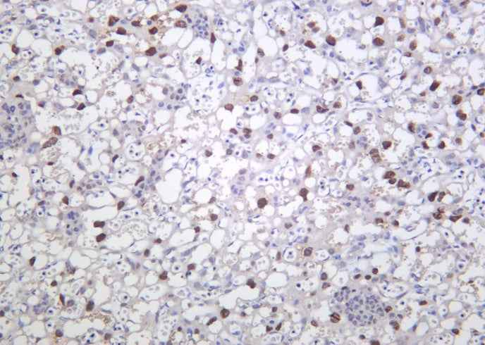 Anti-Human/Mouse PPAR-γ Antibody [B1164]