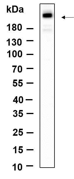 Anti-Human/Mouse/Rat mTOR Antibody [B890] - ABMIUM