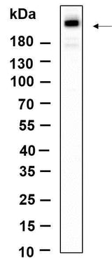 Anti-Human/Mouse/Rat mTOR Antibody [B890]