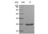 Recombinant Mouse Sonic Hedgehog/SHH (C25II) Protein - ABMIUM