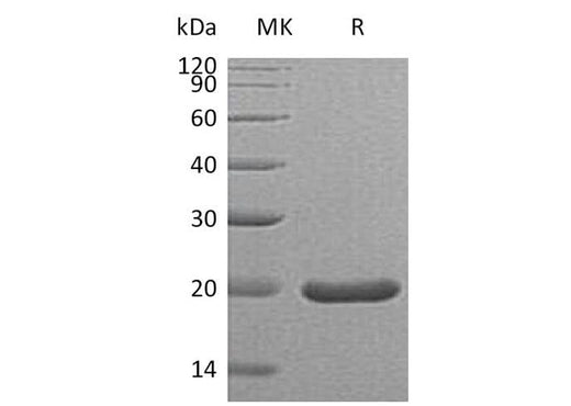 Recombinant Mouse Sonic Hedgehog/SHH (C25II) Protein - ABMIUM
