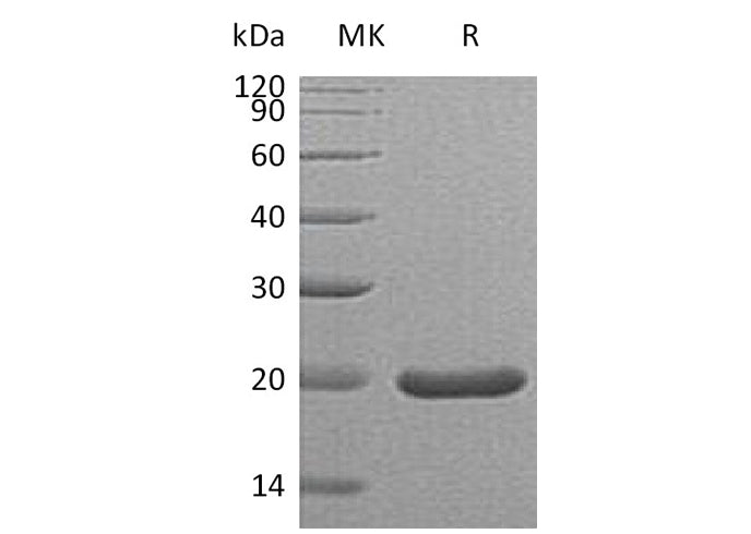 Recombinant Mouse Sonic Hedgehog/SHH (C25II) Protein - ABMIUM