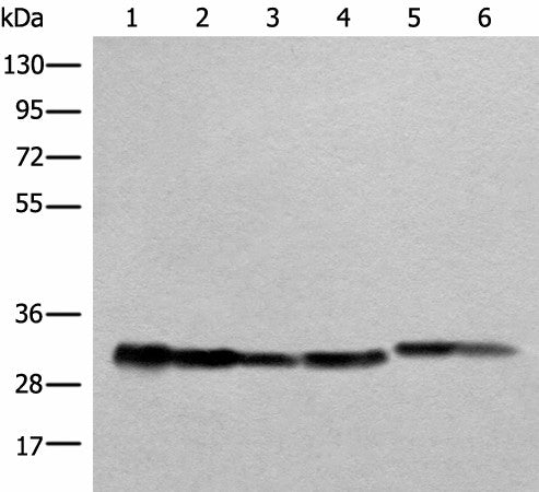 Western blot analysis of Human heart tissue A549 231 Jurkat HEPG2 and Hela cell lysates using ATP5C1 Polyclonal Antibody at dilution of 1:1000