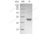 Recombinant Human HPGDS/GSTS Protein - ABMIUM