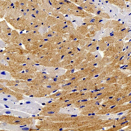 Immunohistochemistry analysis of paraffin-embedded mouse heart using TNNT2 Polyclonal Antibody at dilution of 1:200.