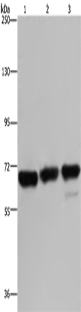 Anti-Human/Mouse PCK2 Antibody - ABMIUM