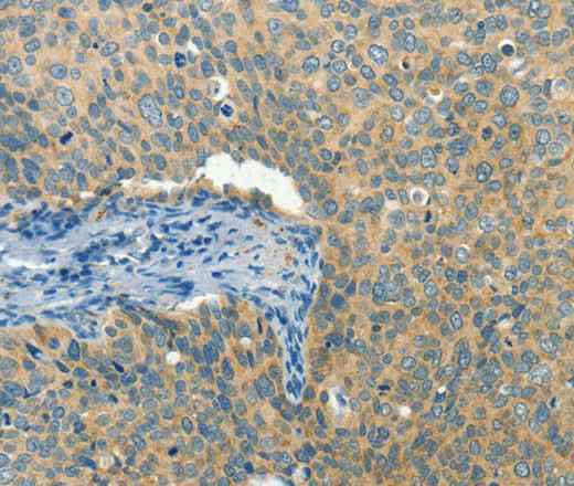 Anti-Human/Mouse BCAT1 Antibody