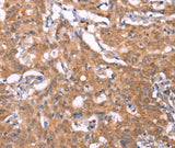 Anti-Human/Mouse/Rat FBXO31 Antibody - ABMIUM