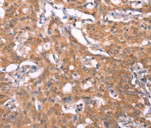 Anti-Human/Mouse/Rat FBXO31 Antibody
