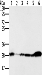 Anti-Human/Mouse NDUFS3 Antibody - ABMIUM