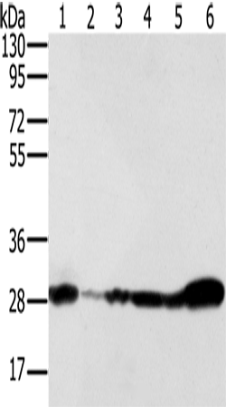 Anti-Human/Mouse NDUFS3 Antibody - ABMIUM