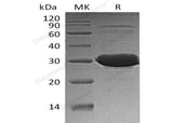 Recombinant Human CLIC3 Protein (His Tag) - ABMIUM