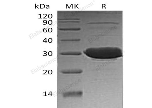 Recombinant Human CLIC3 Protein (His Tag) - ABMIUM