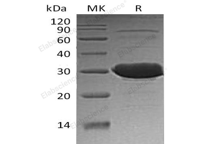 Recombinant Human CLIC3 Protein (His Tag) - ABMIUM