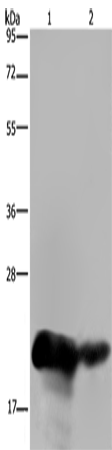 Anti-Human CSH1 Antibody - ABMIUM