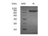 Recombinant Human CD300a/LMIR1 Protein (Fc & His Tag) - ABMIUM