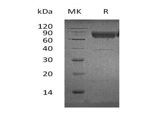 Recombinant Human CD300a/LMIR1 Protein (Fc & His Tag) - ABMIUM