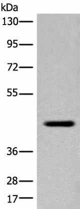 Western blot analysis of Human placenta tissue lysate using FAM105A Polyclonal Antibody at dilution of 1:400