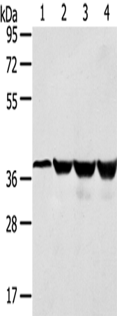 Anti-Human/Mouse/Rat HMOX2 Antibody - ABMIUM