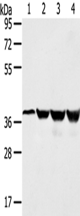 Anti-Human/Mouse/Rat HMOX2 Antibody - ABMIUM