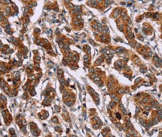 Anti-Human/Mouse/Rat ID2 Antibody