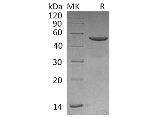Recombinant Human CD99/MIC2 Protein (Fc Tag) - ABMIUM