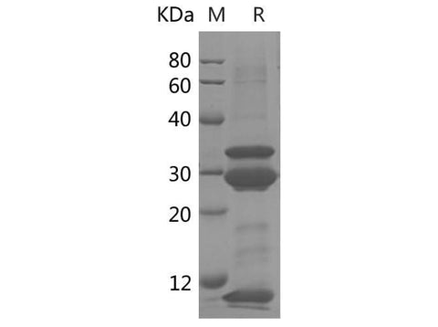 SDS-PAGE analysis of Human IL-8 proteins, 2 μg/lane of Recombinant Human IL-8 proteins was resolved with SDS-PAGE under reducing conditions, showing bands at 9 kDa & 35 kDa.