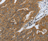 Anti-Human/Mouse/Rat DLG4 Antibody - ABMIUM