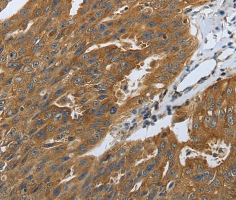 Anti-Human/Mouse/Rat DLG4 Antibody - ABMIUM