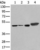 Western blot analysis of Hepg2 A431 Hela and A549 cell lysates using PLAG1 Polyclonal Antibody at dilution of 1:250