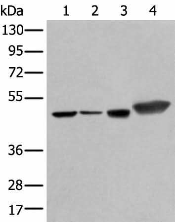 Western blot analysis of Hepg2 A431 Hela and A549 cell lysates using PLAG1 Polyclonal Antibody at dilution of 1:250
