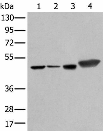 Western blot analysis of Hepg2 A431 Hela and A549 cell lysates using PLAG1 Polyclonal Antibody at dilution of 1:250